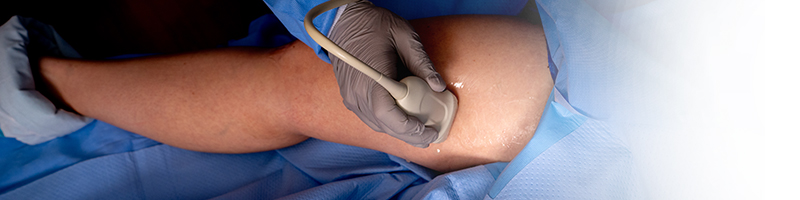 Vein treatment