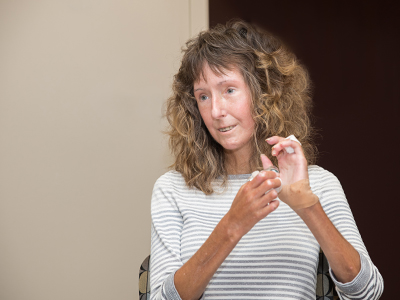 JRMC Wound & Hyperbaric Center patient, Nancy Bader, shares her story and fight against Scleroderma.