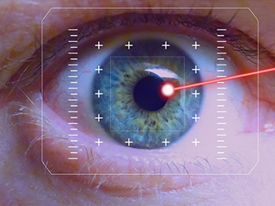 Laser eye correction at JRMC